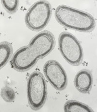 micrograph of Prochlorococcus