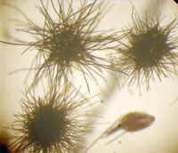 micrograph of Trichodesmium