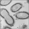 Micrograph of Prochlorococcus.