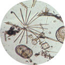 Micrograph of various microbes.