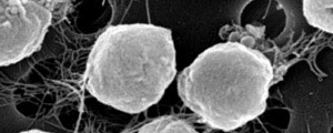 Photo of Methanococcus